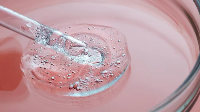 Rekomendasi Produk Skincare dengan Kandungan Salicylic Acid